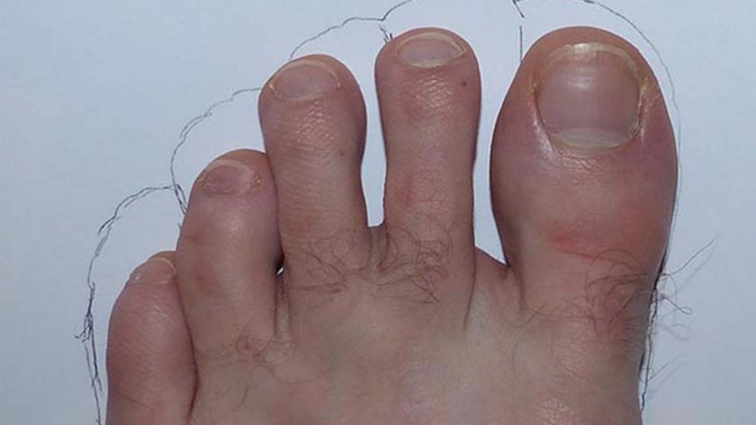 Compatibilité des FiveFingers selon la morphologie des pieds